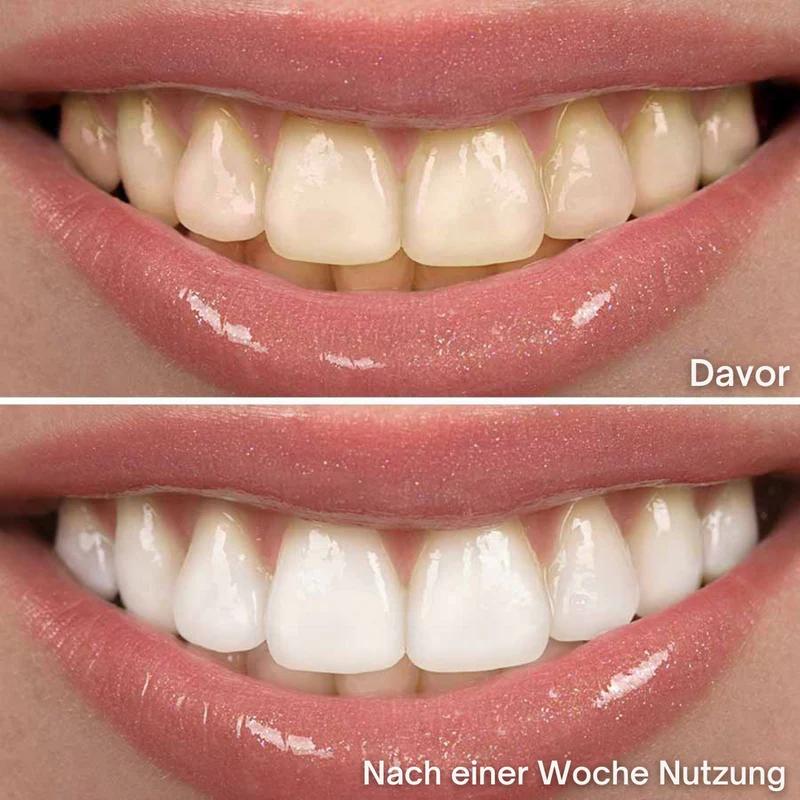 Sonic White™ - Schallzahnbürste für strahlend weiße Zähne